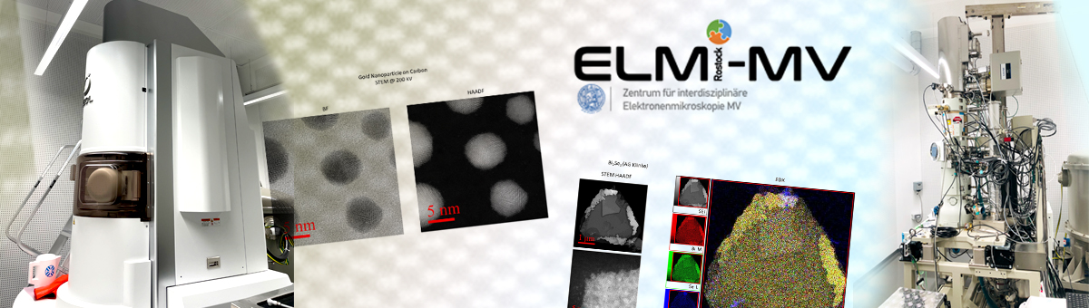 Zentrum für interdisziplinäre Elektronenmikroskopie MV